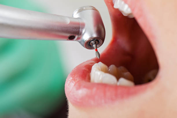 Best Broken Tooth Emergency  in North Eagle Butte, SD